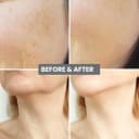 microneedling anti aging serum one week supply (7 pack)